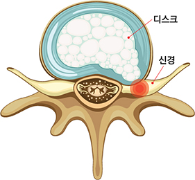 디스크 횡단면